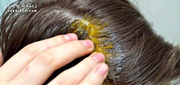 فوائد زيت الثوم لعلاج تساقط الشعر